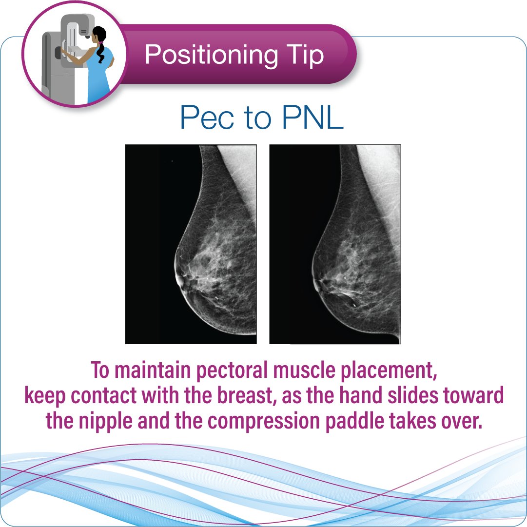 Need to improve your Pec to PNL? Keep contact with the breast until the paddle takes over.#positioningtip #mammography #breastimaging

Meet our virtual coach that helps you reduce retakes bit.ly/2WIVNFm