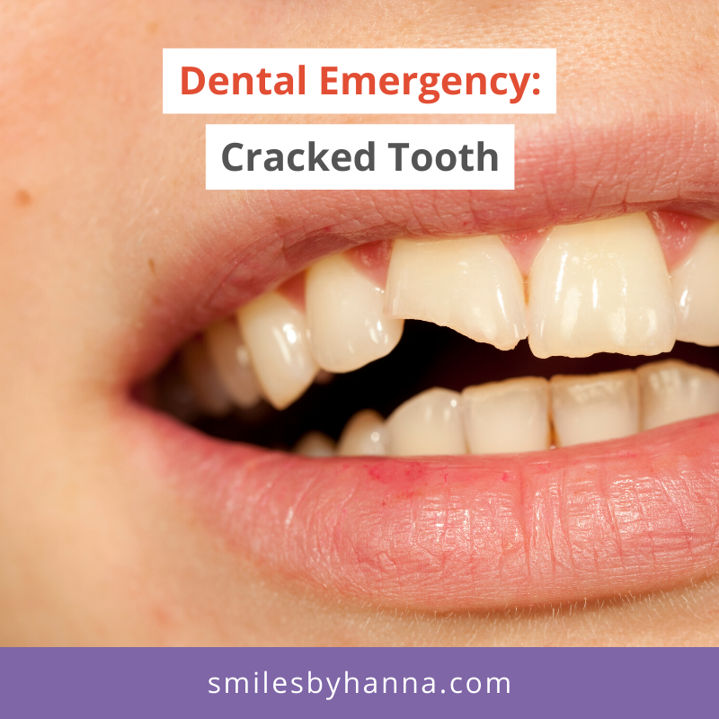 Dentist_Gilbert's tweet photo. If this happens, immediately rinse your mouth with warm water to clean the area. If there’s any swelling, you can also put a cold compress on your face and schedule to see your dentist ASAP.

Call or text us at (602) 413-0580 to schedule an appointment - dental emergencies only! https://t.co/hoD1mJ9F5S