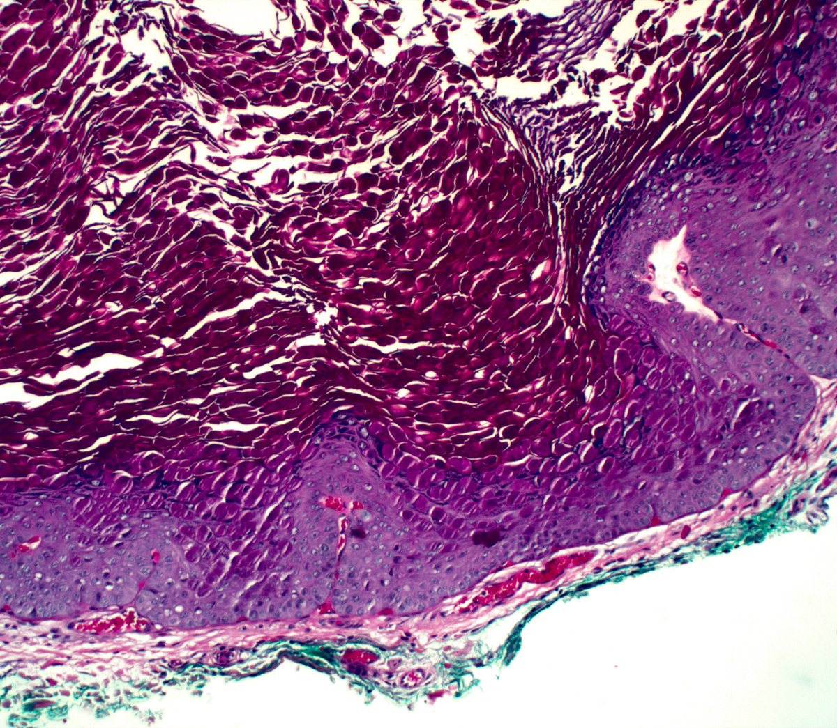 Ryan Hick, MD tweet media