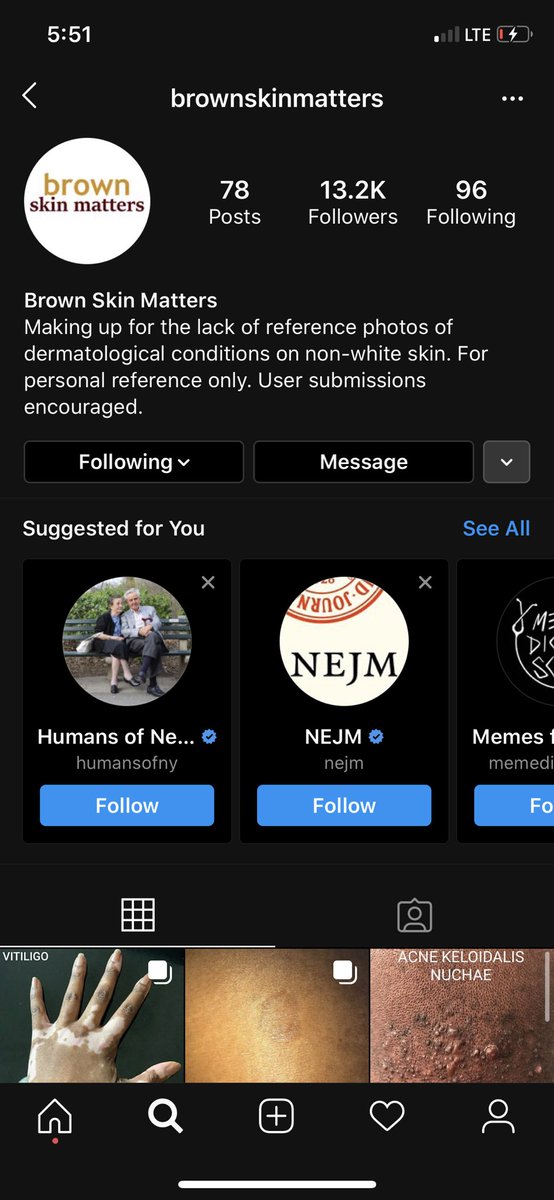 SavXCVIII's tweet photo. @BrwnSkinMatters An awesome insta account to follow!!! I found it while trying to figure out what kind of rash my daughter had going on since google was definitely no help at all. https://t.co/mkIbOr27rQ