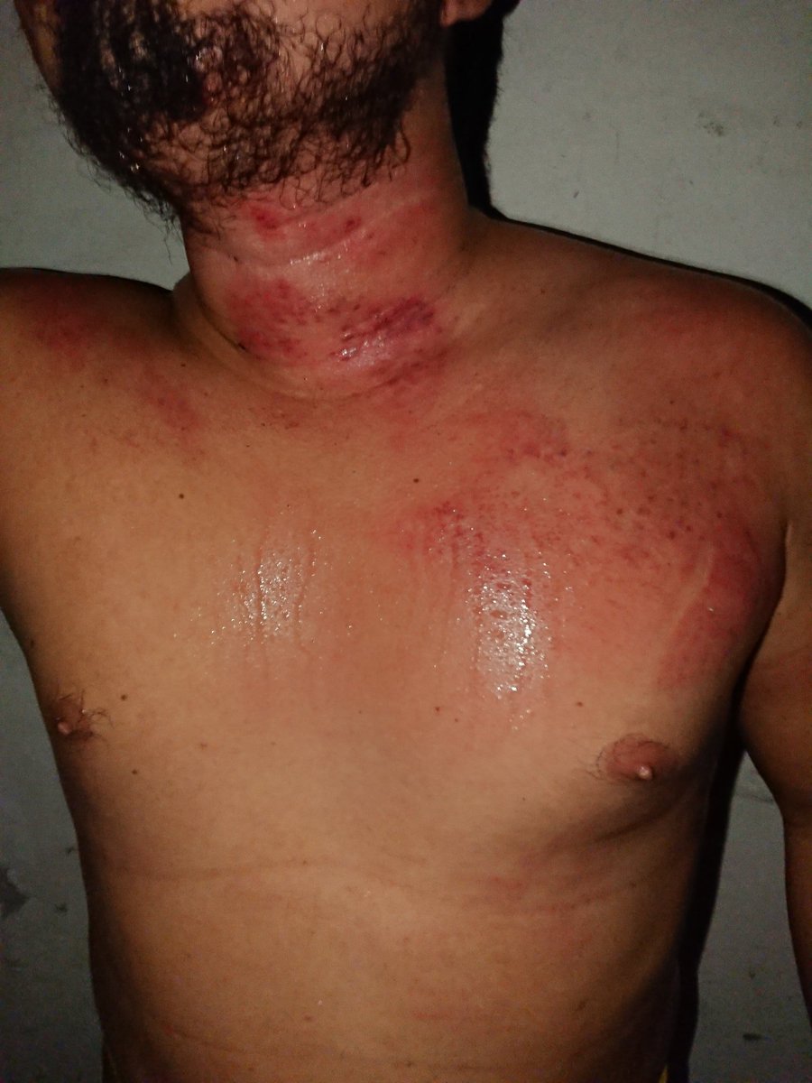 PromoMorenoTap's tweet photo. Nuestro luchador Rey Astaroth asi terminó la lucha después de enfrentar al Gallo Traidor.

#PromocionesMorenp #SIEMPRE_A_LA_VANGUARDIA https://t.co/5fN4SYZr80