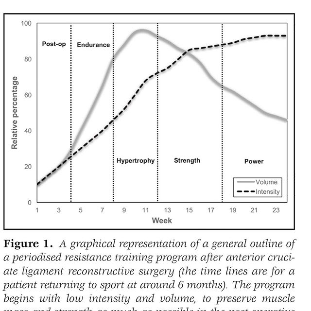 PerformanceGC1's tweet photo. Is your rehab periodised? 🏋️‍♀️
⠀
It is recommended to utilize a periodized resistance training program throughout the ACL rehabilitation program, beginning with optimal post-operative recovery, prior to moderate to high volume low to moderate loads resistance training until fail https://t.co/sP0HVHVxDi