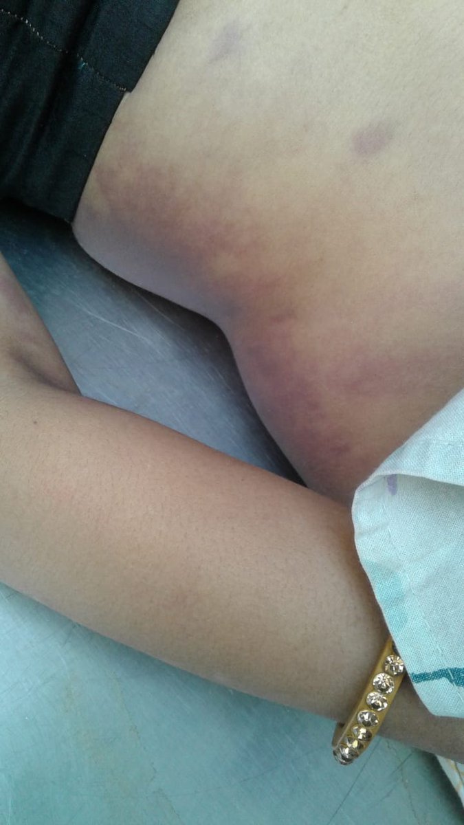 naveen meena tweet media