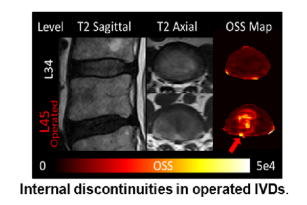 OhioStateMed's tweet photo. Congrats to Dr. Arun Kolipaka, Assoc. Prof of Radiology &amp; Ben Walter of @OhioStateBME for receiving a $2.5M RO1 grant from @NIH for their project: Magnetic Resonance Elastography (MRE) as a Personalized Assessment of Intervertebral Disc Mechanics. #OSUCOM https://t.co/iFAEX2BxOv
