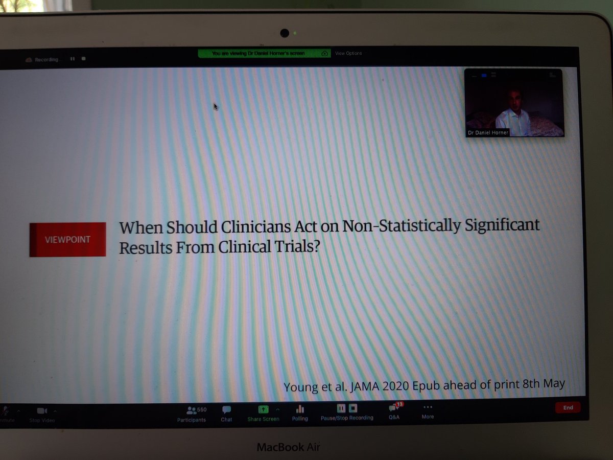 ThrombosisUK's tweet photo. Very challenging decision making and must be on individual basis @RCEMprof  discussing #Thrombosis &amp; #Covid_19 #webinar. Video available shortly on @ThrombosisUK website &amp; @stemlyns blog https://t.co/MVvsJG6nzi
