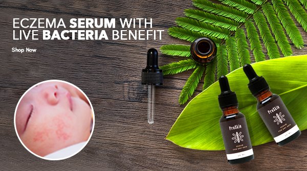 dermedco's tweet photo. 19th May 

Itchy Skin, Eczema needs the right treatment which cares about your baby’s skin and sensitivity. Try ProSkin Serum with Live Bacteria and you will see the results.

#proskin #skinproblemsolution #eczema #eczemarelief  #eczemahealing #eczemaserum #eczematreatment https://t.co/39Rn4rG0rh