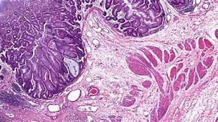 Pathology_2020's tweet photo. @Pathology_2020 
#Anatomical #Pathology
#OnlineConference

Submit your #Abstracts at: https://t.co/B5gUiCmO9y to confirm your slots
Visit: https://t.co/UMa0Rre93o to know more about the conference

#pathology #conference #anatomical #path #science #medical #science #biology https://t.co/eibYZx0Mkz