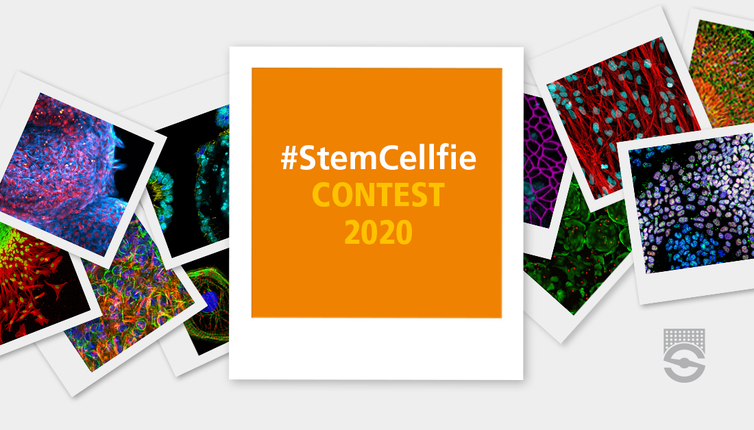 STEMCELLTech's tweet photo. 🚨 The #StemCellfie contest is now open for voting! 🚨
Join us in celebrating the beauty of your colleagues' research by voting for your favorite cell image(s): https://t.co/aViJYfrUNZ
#Cellfie #SciArt https://t.co/EUkvidcfJ2
