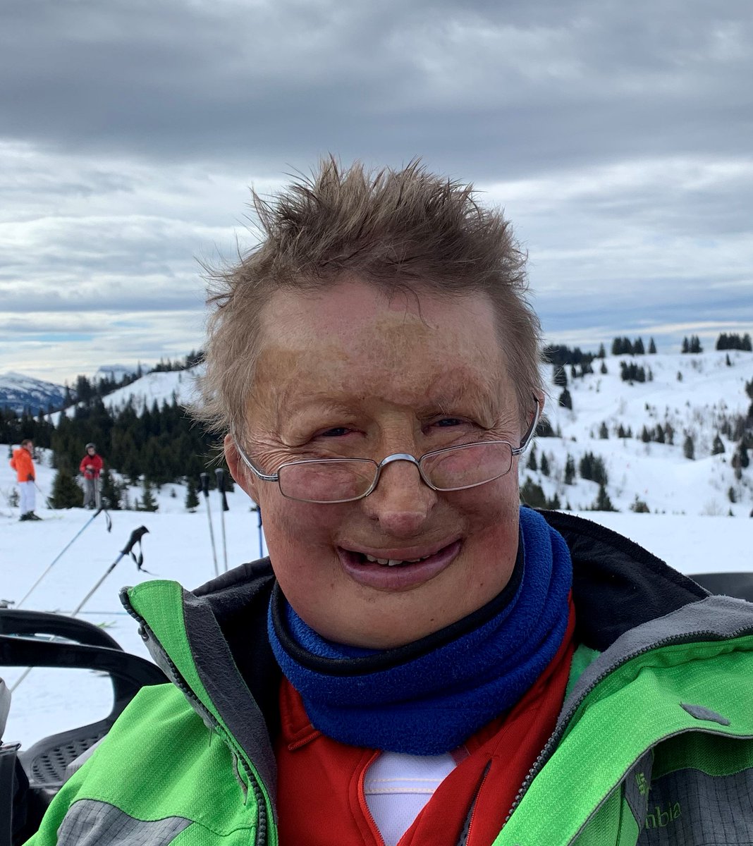 DeardenPhillips's tweet photo. So chuffed that James Partridge @JRJPartridge will be our speaker on 2nd June.  James is founder of Changing Faces @FaceEquality &amp; Face Equality Int. @FaceEqualityInt - &amp; author. Can't wait to hear more about the new book.  Like to join?  Follow @SocialClubUK &amp; request link https://t.co/WaqBYXugZw