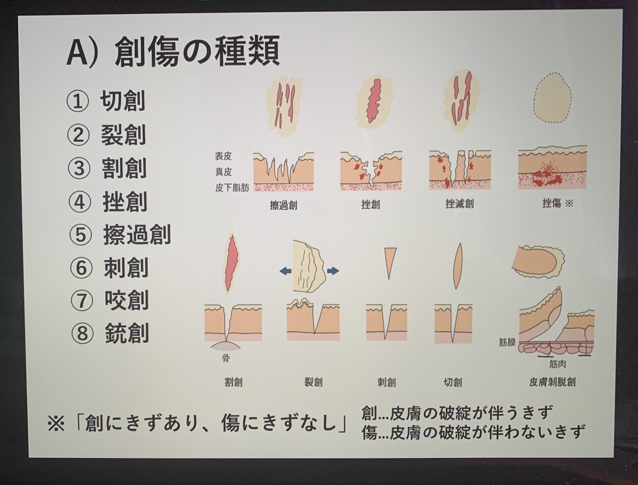 常葉大学atサークルcats 第6回目の勉強会を行いました テーマは 傷と止血 でした 現場で傷を負った選手に しっかり対応できるように ルールや止血法を学びました 勉強会で行なっていることをインプットするだけではなく アウトプットもできるように