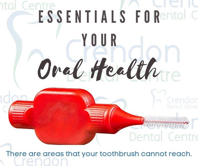 CrendonDental's tweet photo. It is important to use interdental brushes (such as TePe brushes) to clean between your teeth every day. 
Interdental brushes get to the areas your toothbrush cannot reach. You should select interdental brushes that fit snugly between your teeth. #dentalcare #oralhealth #dentist https://t.co/Cy3qdcp49a