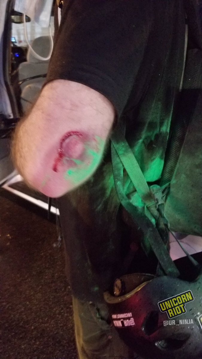 Our reporter Niko was just injured by a projectile shot at him by  @MinneapolisPD while he was documenting their interactions with protesters upset by last night’s police murder of George Floyd.