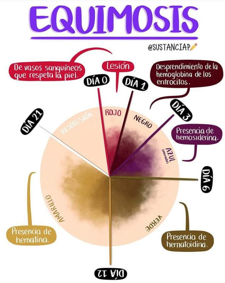 X 上的REMEVET：「Etapas de un hematoma o equimosis. Imagen:@sustanciap  https://t.co/n1HKFFVwSB」 / X
