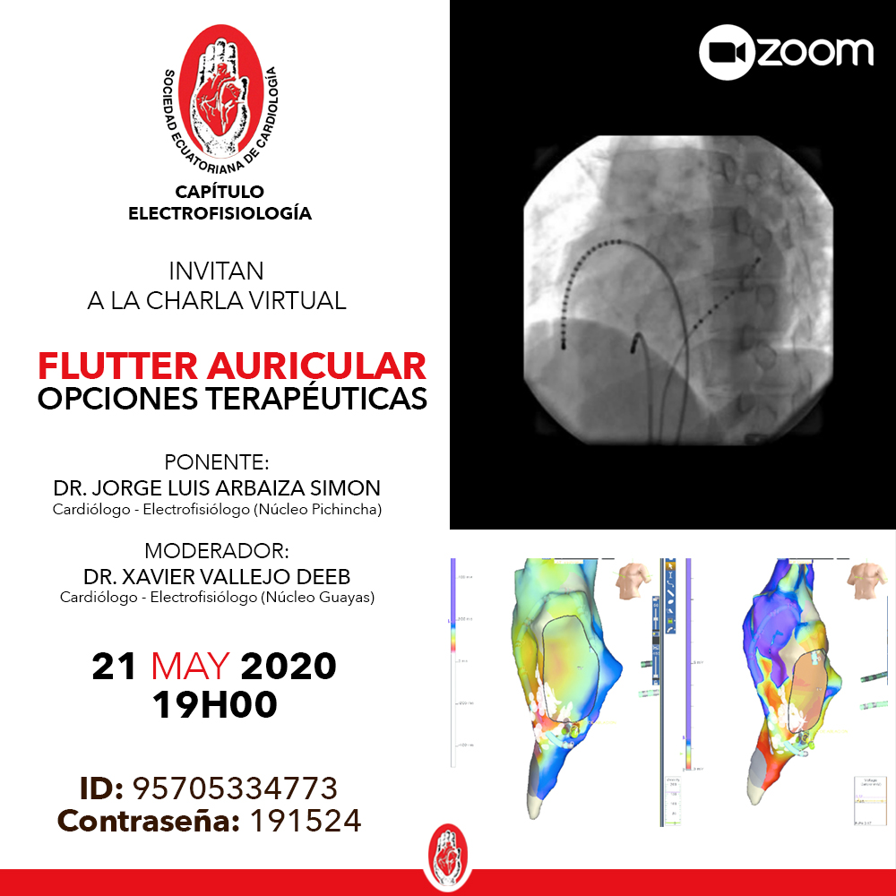 Te invitamos al webinar: Flutter Auricular - Opciones Terapéuticas

👉 ID: 95705334773
👉 Contraseña: 191524
.
#sec #sociedadecuatorianadecardiologia #cardiologia #cardiologos #flutterauricular #opcionesterapeuticas