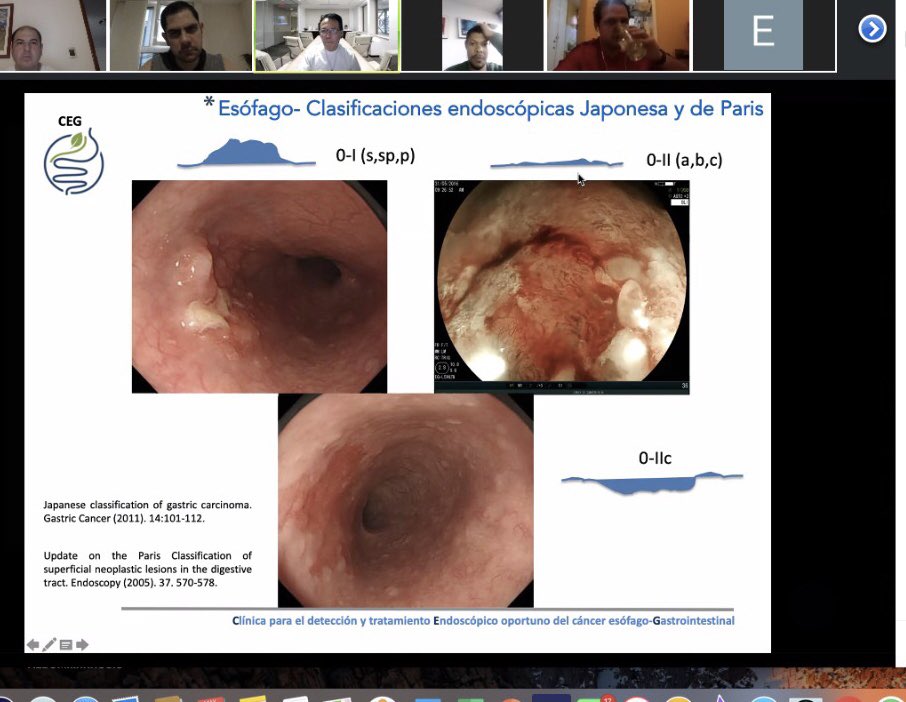 velardemd's tweet photo. Gracias por participar en la sesión de nuestro servicio @Gastrocivil Dr @matanimoto1 y compartir técnicas de Disección endoscópica, conocimiento muy útil en la formación de nuestros residentes https://t.co/WHoPzk8eBq