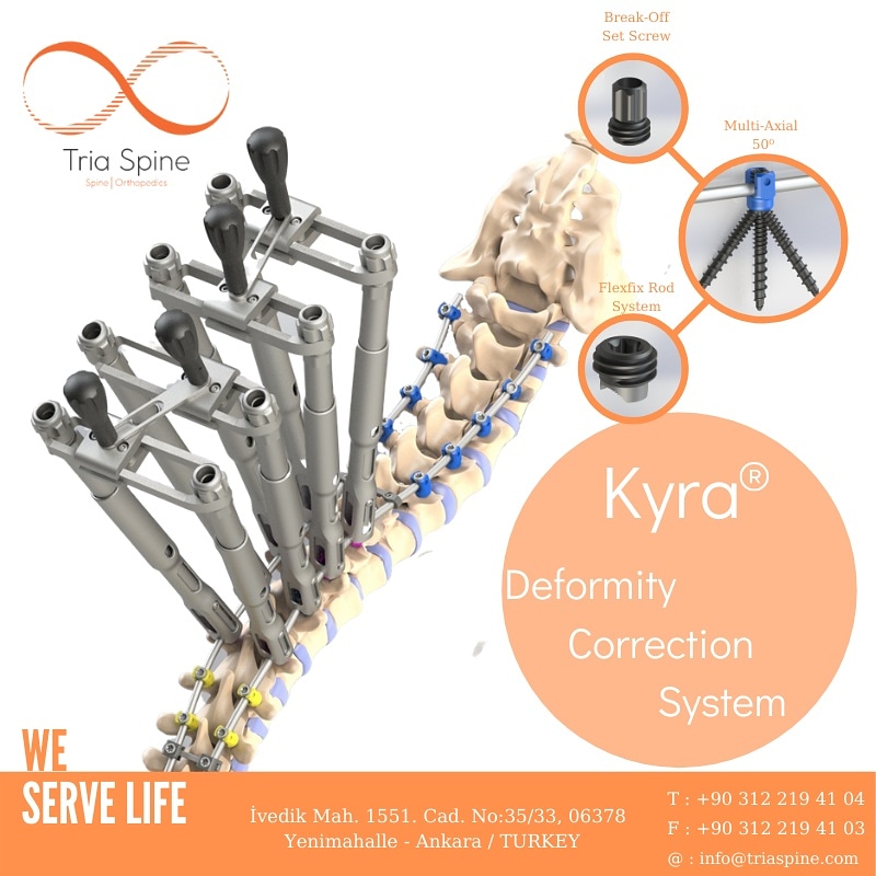 Tria Spine proudly presents the KYRA Deformity Correction System.
📍Multi-Axial System
📍Break-Off Set Screw
📍Flexifix Rod System

#triaspine #kyradeformitycorrectionsystem #spine #spinehealth #spinesurgery #spinesurgeon #scoliosis #scoliosissurgery #spinalimplant #spineimplants