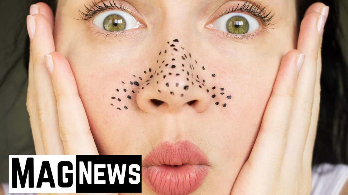 The best solution to eliminate blackheads and remove them completely !!.
#Ramadan
#healthcare
#Covid_19
#Tweet
bit.ly/3bLs8zN