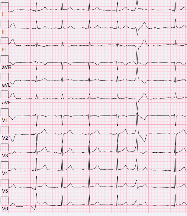 GStokken's tweet photo. SOO?
#EPeeps #ECG https://t.co/8WOnPxR1Hq