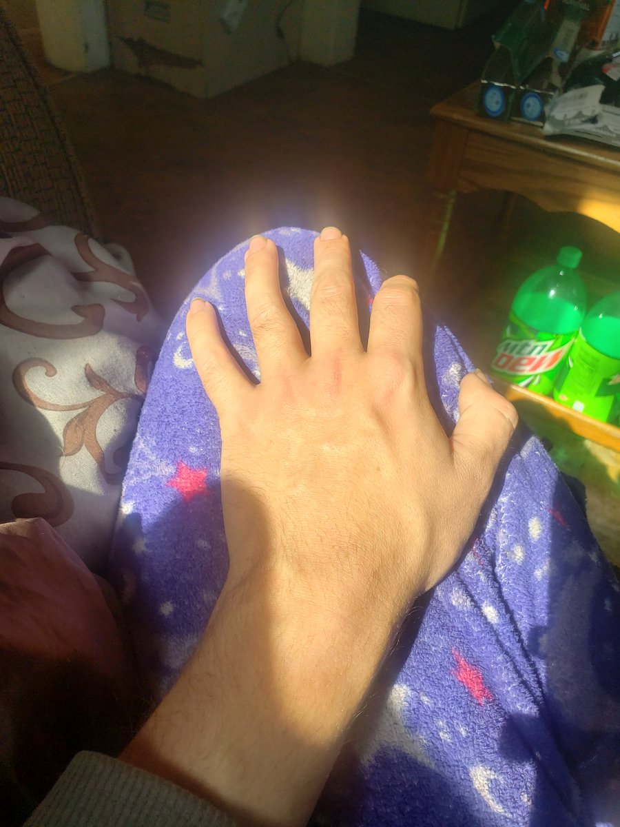 Zero87552330's tweet image. It is weird pointless fun being a #Shaman and #worldserver you seek data no one else does yet. Today we work on physical UV gauge. New high of 8 this year.