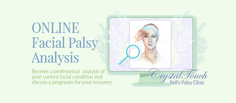 Q&A Archives • Crystal Touch Bell's Palsy Clinic