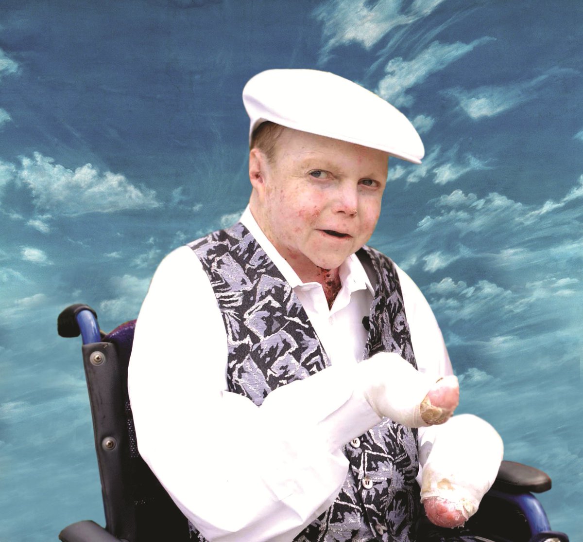 CharityDEBRA's tweet image. International Emmy Award winning @Channel4 documentary 'The Boy Whose Skin Fell Off' is on air tomorrow, Thursday 21st at 10pm. It is incredibly moving as it follows the final months of Jonny Kennedy, showing the brutal reality of living and dying with severe EB. #FightEB