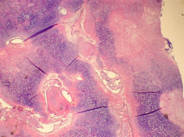 Pathology_2020's tweet photo. @Pathology_2020 
#Hemato #Pathology
#OnlineConference
Submit your #Abstracts at: https://t.co/B5gUiCmO9y to make your slots confirm &amp; visit: https://t.co/UMa0Rre93o to know more about the conference

#pathology #conference #hemato #path #science #research #science #medical #bio https://t.co/DRhA2Fl15i