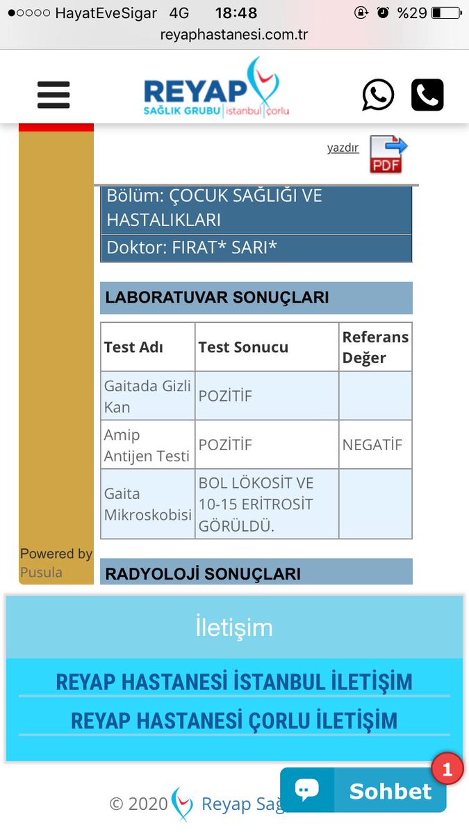 halilozgen1's tweet photo. @BulutGulcuN @DocEkiz Merhaba Nebahat Hanım
Altı aylık bir bebeğimiz var üç hafta önca kakasında küçük bir kan gördük ara ara olmaya devam edince doktorumuz kaka tahlili istedi  tahlil sonuçları ekteki gibi çıktı. https://t.co/YcRbsPUpq0