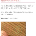 えー!そうなの？!「両足の小指の爪の端が割れて生えている人」。それは「第6の指」である可能性があるらしい。