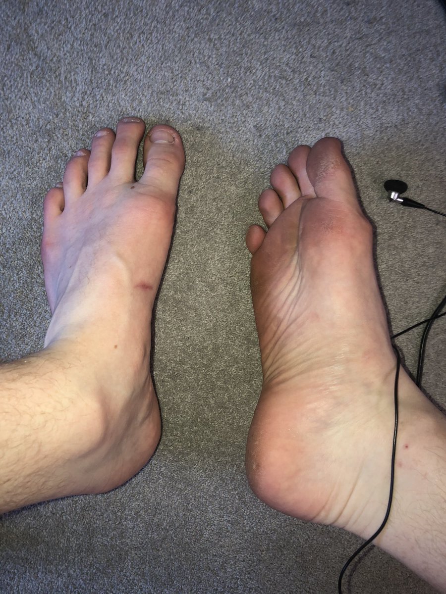 Dfootman2's tweet photo. Who wants to come and suck on these size 12 feet!! Nice and sweaty after my 10k 🏃‍♂️🦶🏽

Which of you subs are going to treat this alpha! 😈. 

Cashapp - £masterdfm

#findom #male #feet #sock #run #paypig #reimburse #cashpig #sweat #sweaty @Cuckertt @RT4Masters @rtfindom https://t.co/E7U3KZAVdp