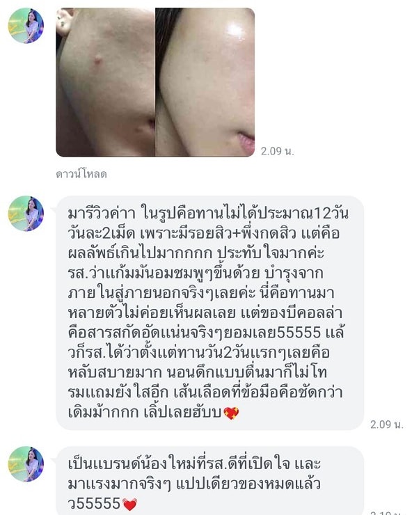 Oain_ainM's tweet photo. นอนดึกก็ไม่โทรมเด้อ แล้วผิวคือสวยอมชมพูอีก
#รีวิว
#คอลลาเจน #collagen #becolla #อาหารเสริม #ของดีบอกต่อ #ใช้ดีบอกต่อ #ไว้รีวิวห้ามขายของโว้ย #ไว้รีวิวห้ามขายของโว้ยย #ไว้ขายของห้ามรีวิวโว้ยยย #howtobeauty #howtoperfact #HowtoPerfect #ฉันจะขาว #ฉันจะสวย #ผิวขาวใส #ผิวขาว #ดีบอกต่อ https://t.co/zDHXZsMEdQ
