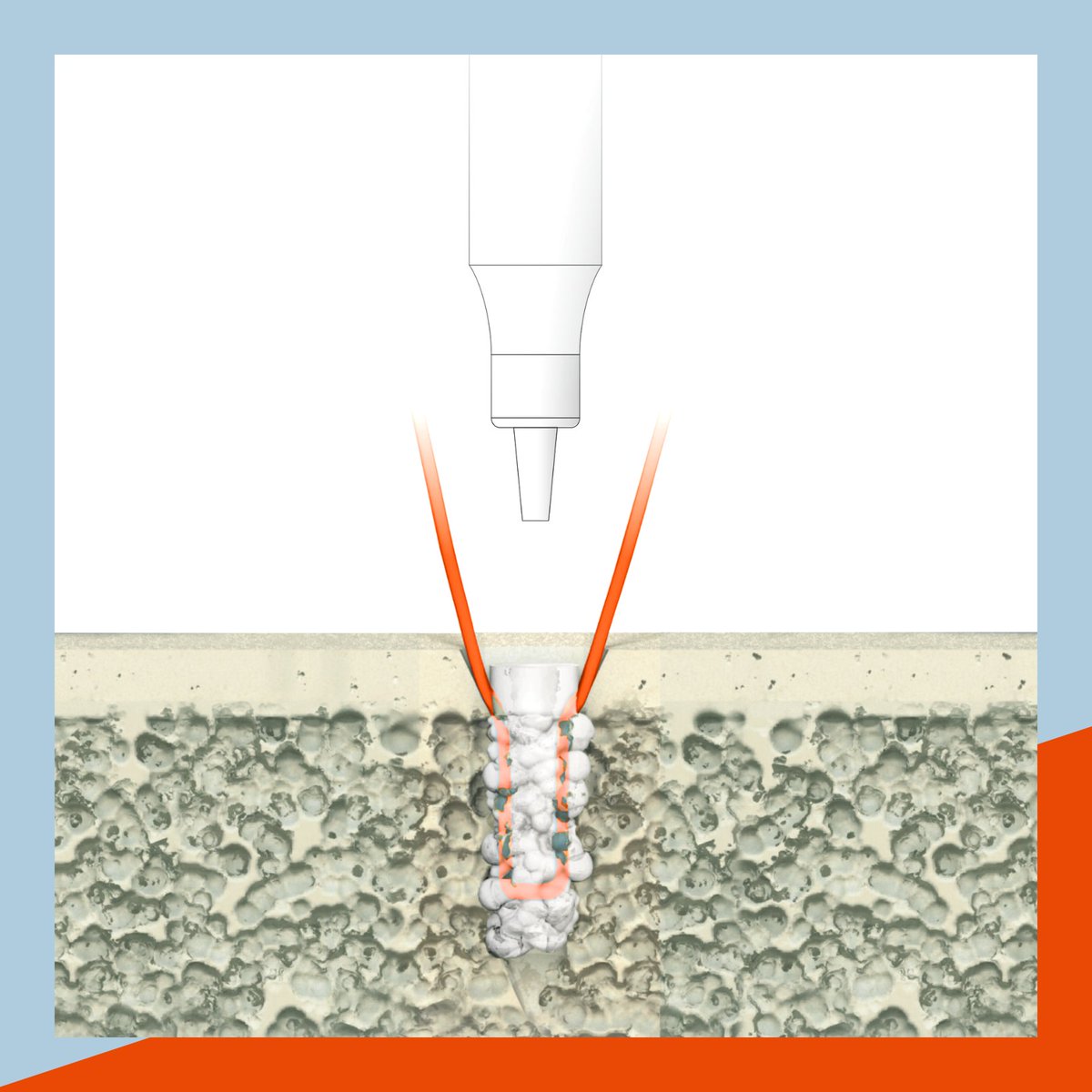 VetWelding's tweet photo. The #BoneWelding® #technology immediate 3D bond creates an excellent anchorage in the #bone, resulting in superior primary stability and eliminates micro motions. Find out more https://t.co/UGtoSXJvyW
#vetwelding #revolutionizinganimalorthopedics #surgeon #weldix #boneweldervet https://t.co/BqHH1ofa7L