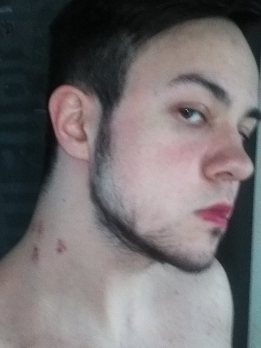 Last night was hooot, just look on my neck!!! https://t.co/8pBGmS2fZU<a href="/tag/ftm"class="tags"><span>#ftm</span></a><a href="/tag/ahegao"class="tags"><span>#ahegao</span></a><a href="/tag/transguy"class="tags"><span>#transguy</span></a>
