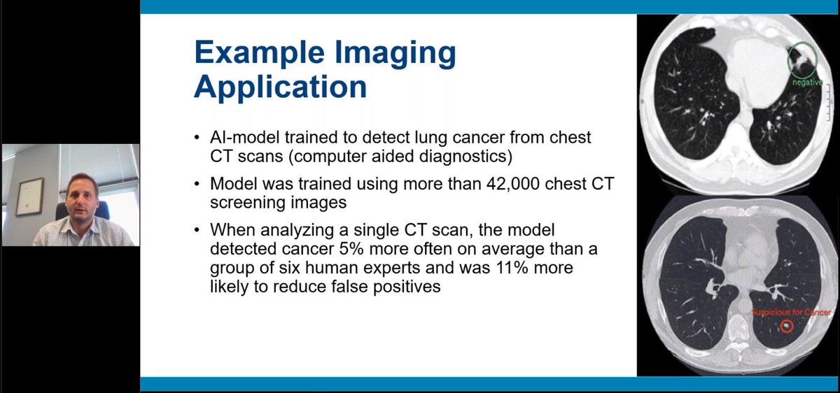 vision_a3's tweet photo. We're seeing incredible technology during #AIAVisionWeek! Darcy Bachert with @prolucid showed an example of how #ai was trained to detect lung cancer -- which gave better results than human experts. Learn more https://t.co/kbXol0Y8ks https://t.co/t1tjzLWe1j