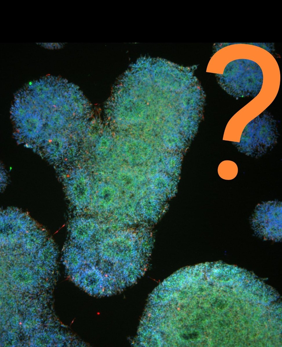 MarcelTisch's tweet photo. Day 62 of culture:
"But y?" - The cells begin to question their existence. #generation_y https://t.co/1OxKVzbS5a