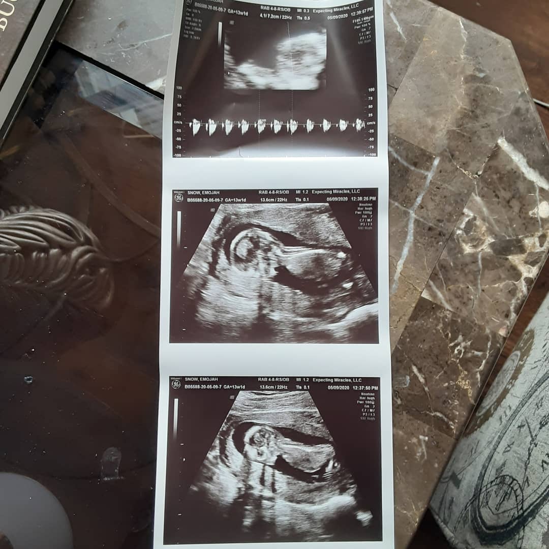 Shakeera1215's tweet photo. I'm so GRATEFUL to God for my New Grandbaby on the way  I Love my oldest daughter E'mojah ❤ Ur so Beautiful pregnant and all😘
#TeamBoy💙 https://t.co/uMMMWDJwRH