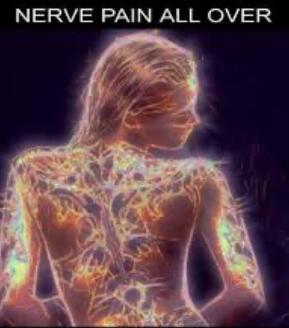 VarshaTailor8's tweet photo. I am seriously missing discontinued treatment @uclh Royal London Hospital for Integrated Medicine. My walking is deteriorating as is the dexterity in my hands but my pain is increasing #acupuncture #ms #neurological #nervepain #nerveconduction https://t.co/ewhorHBOJu