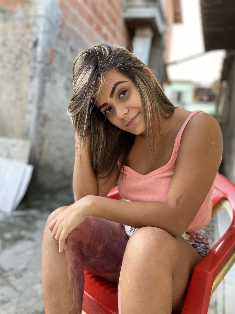 cassirufino's tweet photo. Imperfeições... 🤷🏻‍♀️😓🥰 https://t.co/C3mlJiPS9S