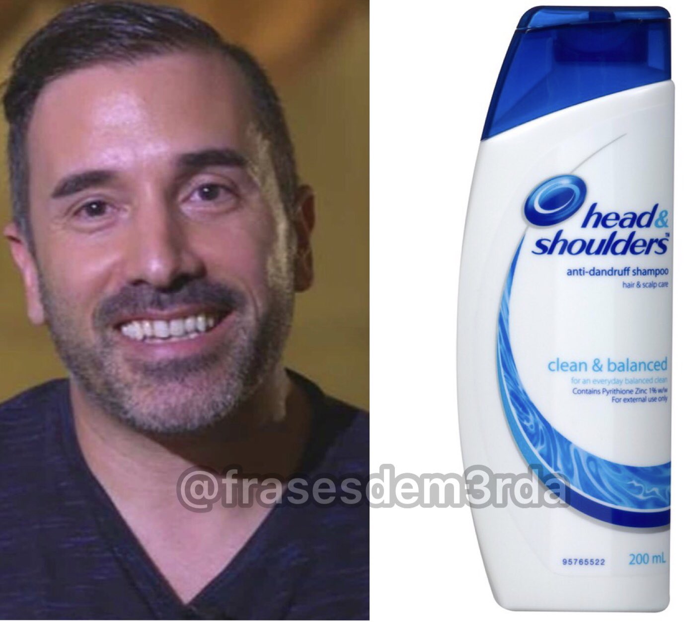If head and shoulders on sale was a person