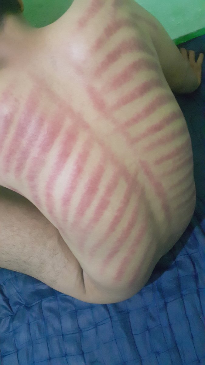 Angga23751968's tweet photo. https://t.co/DG757JQH3Q