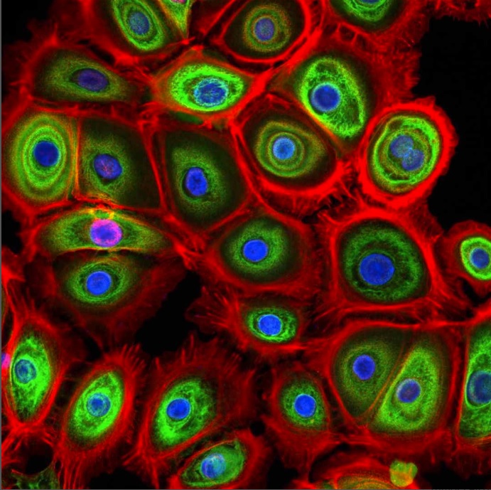 Hudson Institute of Medical Research (@hudson_research) on Twitter photo Let's get behind <a href="/kusuma_gina/">Gina Kusuma</a> team Hudson! Vote for her #stemcellfie here: stemcell.com/stemcellfie <a href="/CiiiD_Hudson/">CiiiD Hudson</a> <a href="/RitchieCentre/">The Ritchie Centre</a> <a href="/CEM_Hudson/">CEM_Hudson</a> Let's get behind <a href="/kusuma_gina/">Gina Kusuma</a> team Hudson! Vote for her #stemcellfie here: stemcell.com/stemcellfie <a href="/CiiiD_Hudson/">CiiiD Hudson</a> <a href="/RitchieCentre/">The Ritchie Centre</a> <a href="/CEM_Hudson/">CEM_Hudson</a>