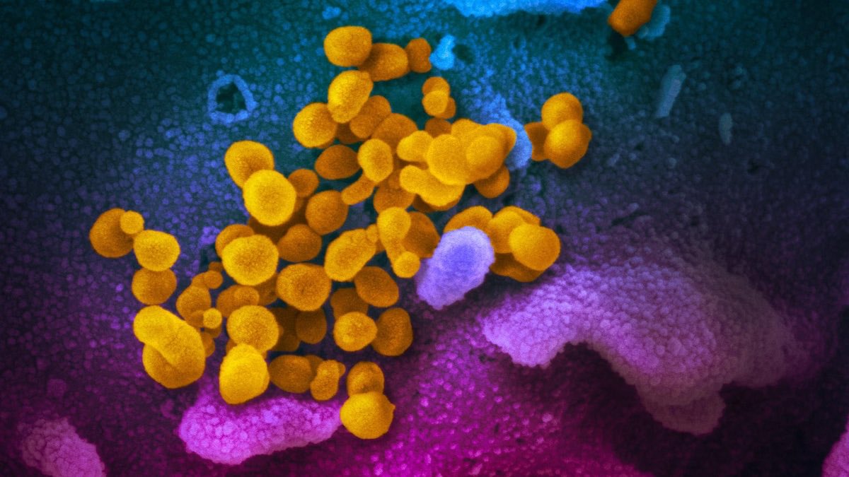 CatLoganRC's tweet photo. Un essai clinique pour vérifier si l’héparine peut traiter la COVID-19 - une collaboration de
⁦@UHN⁩ ⁦et @umanitoba⁩ #coronavirus #COVID2019 #heparin  https://t.co/iC8nmspGr9 https://t.co/DweIX8BPOB