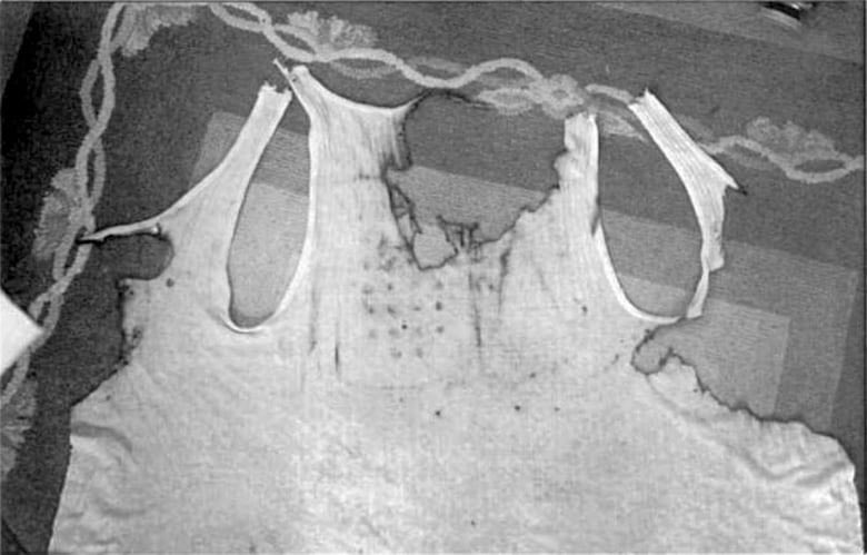 MAY 20 1967
 
FALCON LAKE UFO INCIDENT
 
Stan Michalak (51) is badly burned by UFO taking off, hospitalized in Manitoba, Canada.👇
 
He saw bright lights inside UFO. His clothes, soil were radioactive &amp; he became sick. UFO event “flipped our lives over.”
 
Blue Book: UNEXPLAINED