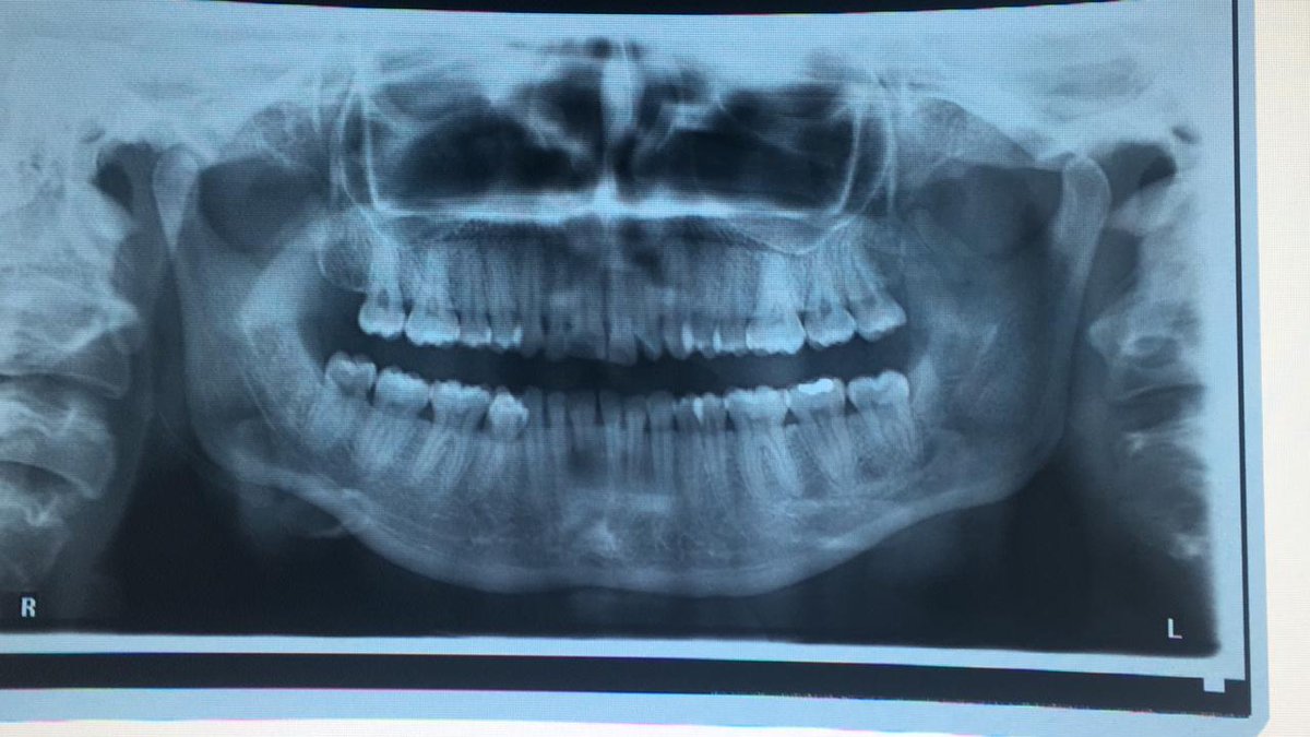 jupecojo's tweet photo. Una imagen no es sufienciente para diagnosticar. Queremos volver a la clinica!! #SoyOdontologo https://t.co/rGIVEahIAh