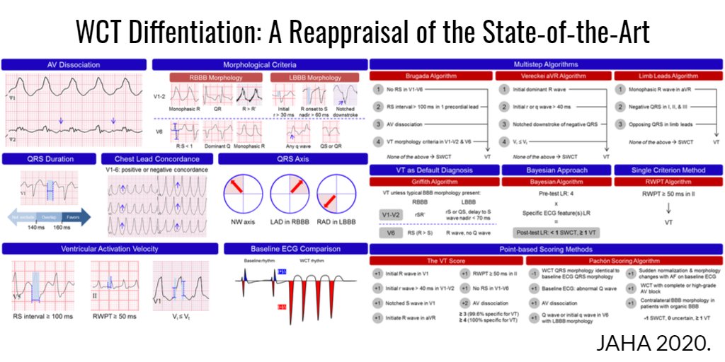 TheEKGGuy's tweet photo. A fun one to write. I hope you enjoy our recent work (and images!) in @JAHA_AHA 

Wide Complex Tachycardia Differentiation: A Reappraisal of the State‐of‐the‐Art

Read here: https://t.co/5g45kVzjBA https://t.co/IM2TTZFtaj