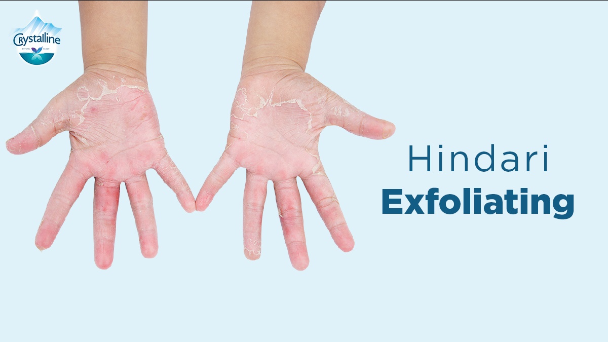crystalinid's tweet photo. 3. Hindari Exfoliating
Melakukan exfoliating atau pengelupasan sel-sel kulit mati dari permukaan terluar dapat membuat kulit semakin kering lho.
#CrystallineWater #CrystallineTips https://t.co/vp3E3mN1xo