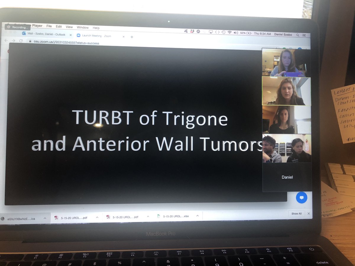 OSU_Urology's tweet photo. Dr. Kamal Pohar leads this morning’s virtual surgical education session with case examples, videos, and a discussion of #TURBT for our residents and advanced urology medical students. @Geoff_Box @ctleeuro @OSUWexMed @OhioStateMed #MedEd #SurgEd #SocialDistancing https://t.co/xL04KNAlbF