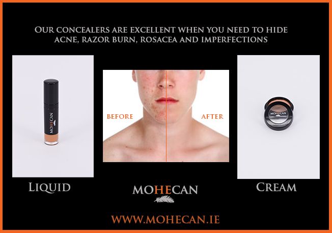 MohecanMale's tweet photo. Quickly and discreetly cover spots, rosacea and razor burn with Mohecan concealer for men.
https://t.co/Hi4Wv4mVdv 
. 
#concealerformen #cosmeticsformen #maleskincare #startups #irishcompany https://t.co/5TnXP6dmAj