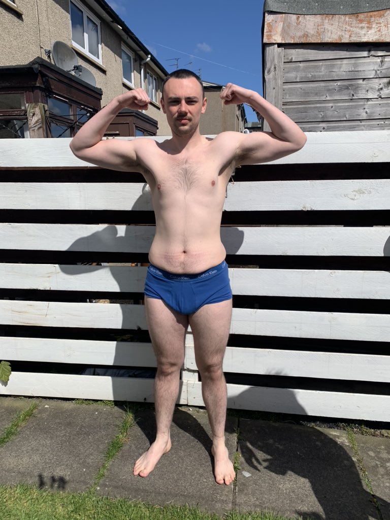 kombuchajay's tweet photo. My recent 96 hour hard dry fast!

First pics - 13:30 27/04 182lbs/82.5kg
Second - 15:15 01/05 168lbs 76.2kg 

Had been eating too much during lockdown and hadn’t participated in a prolonged fast for around 2 years

#dryfast #autophagy #prolongedfast https://t.co/9O2MOcRDHv
