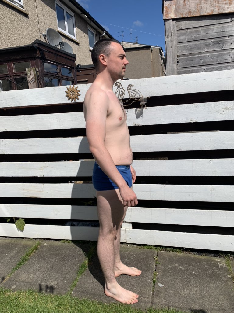 kombuchajay's tweet photo. My recent 96 hour hard dry fast!

First pics - 13:30 27/04 182lbs/82.5kg
Second - 15:15 01/05 168lbs 76.2kg 

Had been eating too much during lockdown and hadn’t participated in a prolonged fast for around 2 years

#dryfast #autophagy #prolongedfast https://t.co/9O2MOcRDHv