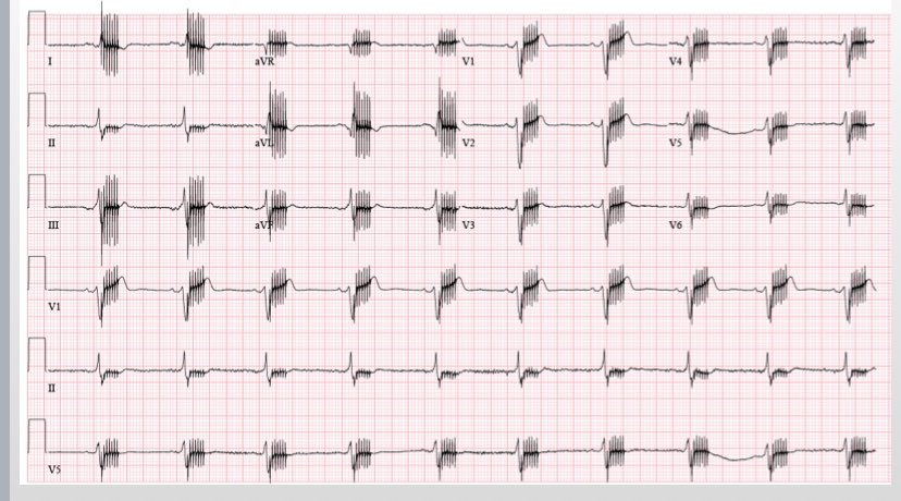 Peter Jessel tweet media